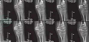包含LPw&?瘢$<婘?鋥r蜢的词条